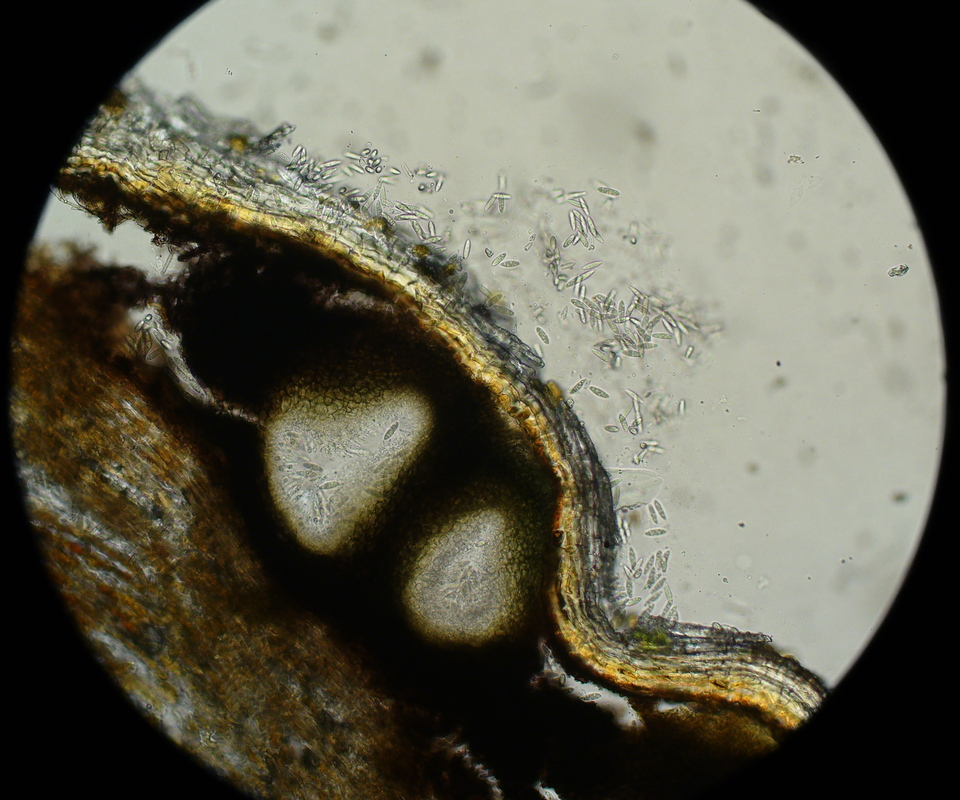 Imagem de microscópio de ramo com cancro-papel, causado por <i>Botryosphaeria</i> sp.