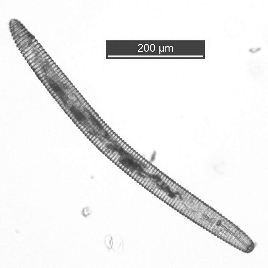 Nematoide-anelado <i>Mesocriconema xenoplax</i>